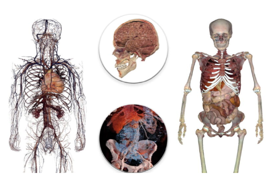 VR 应用《 Anatomage VR 》发布，提供专业医学解剖知识