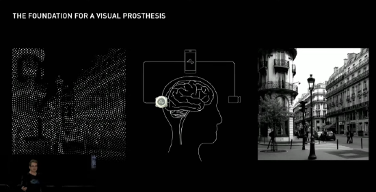 Neuralink 脑机接口计划在明年进行人体植入测试