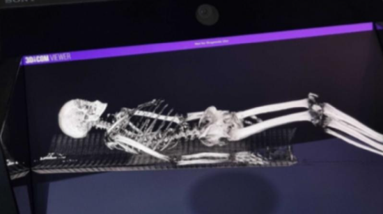 索尼与 Singular Health 合作推动 3D 医学可视化