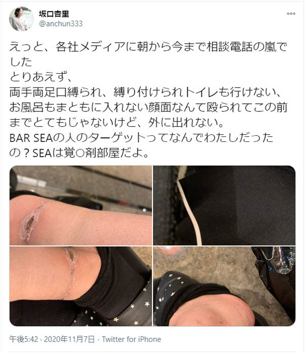 被黑道捆绑殴打！？坂口杏里流出很锵的影片！