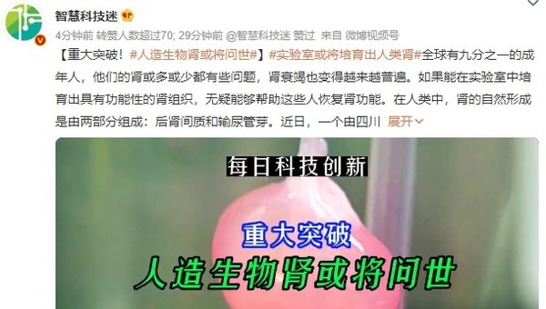 肾病患者的福音！人造生物肾或将问世 网友评论亮了