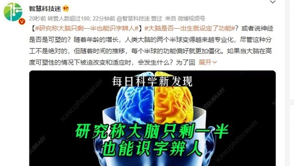 太神奇了！研究称大脑只剩一半也能识别文字和面孔