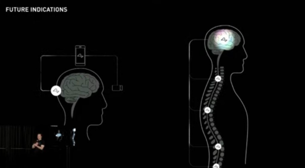 人类福音?马斯克相信Neuralink将恢复视力和全身功能