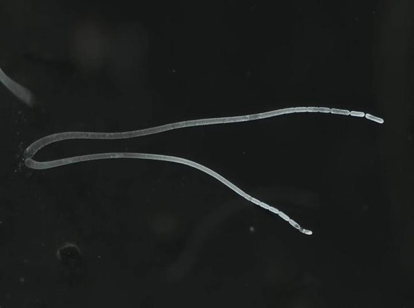 肉眼可见！科学家发现2厘米长巨型细菌 长得像睫毛