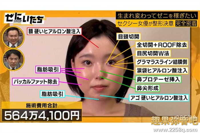[NNPJ-557]想成为最顶的专属女艺人！ 古贺裕子花了564万日币全身整形！